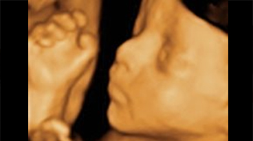 3D ultrasound close up of a baby's facial features