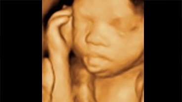 HD Live ultrasound portrait of an unborn baby