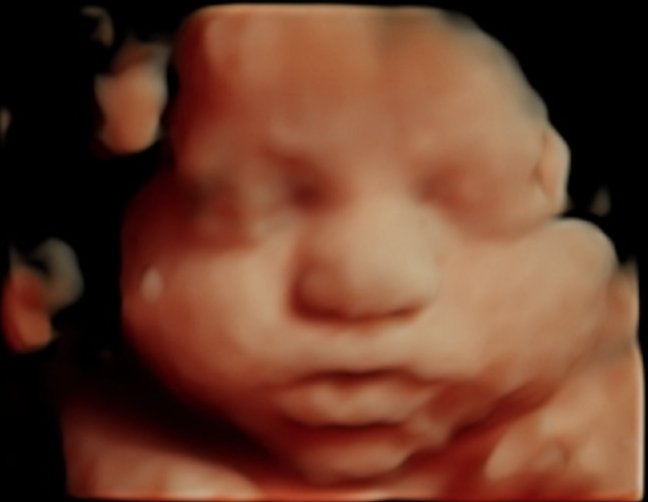 HD Live 8K rendered 3D ultrasound portrait of an unborn baby's face