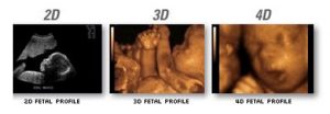 ultrasound pictures